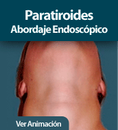 Paratiroides - Abordaje Endoscópico
